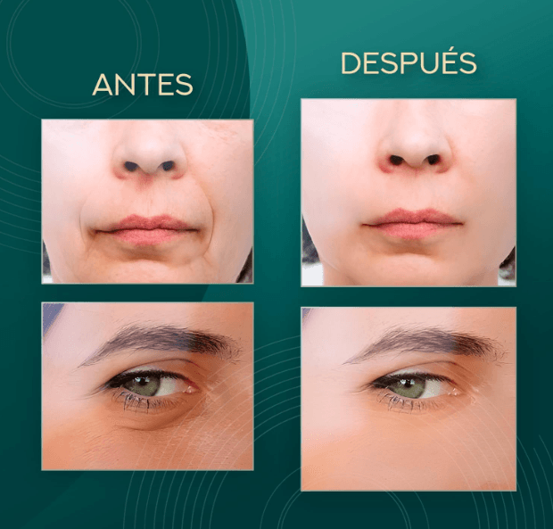 Aparelho Radiofrequência Massajador Facial 5 em 1 - 5ª Geração - 4