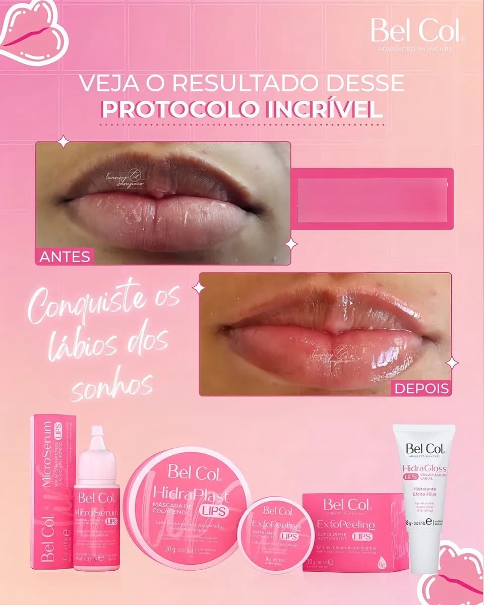 Kit Hidra Lips Tratamento Labial Hidragloss - Bel Col - PRÉ-VENDA📍 - 5