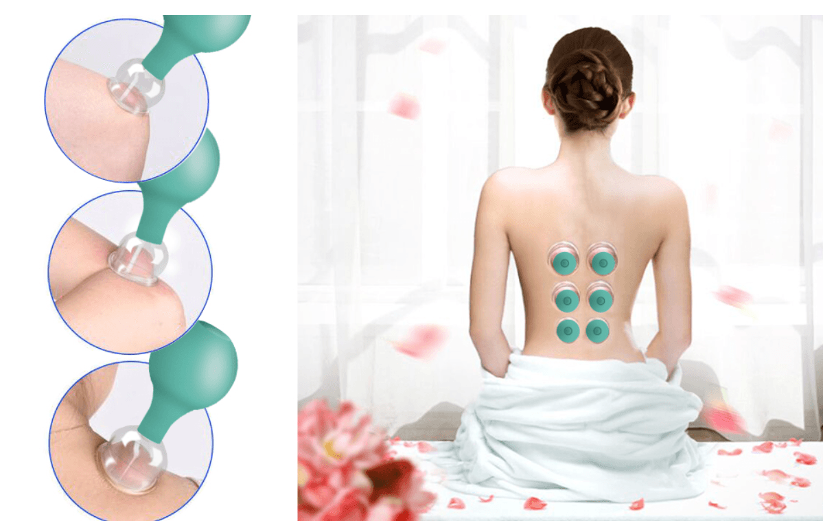 Kit Ventosas de Vidro para Ventosaterapia 5 Unidades - 2