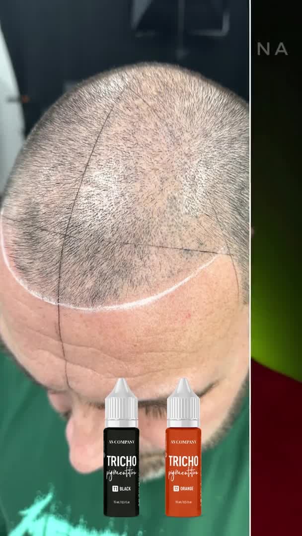 Pigmentos para Tricopigmentação 15ml – AS Company - 8