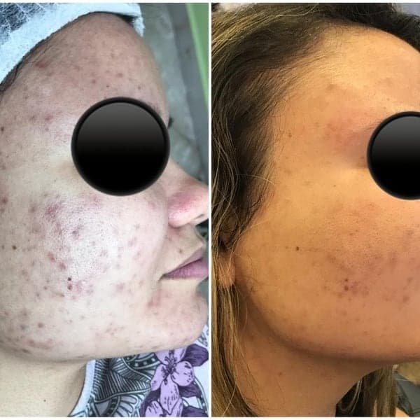 Kit Profissional Rose de Mer - 2