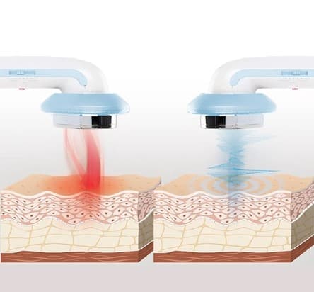 Ultrasom Portátil Cavitação Corporal 3 em 1 - 4