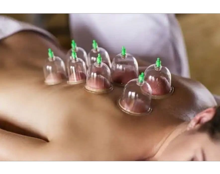 Kit 12 Copas Ventosas + Bomba Masaje Ventosaterapia Vacuoterapia - 3