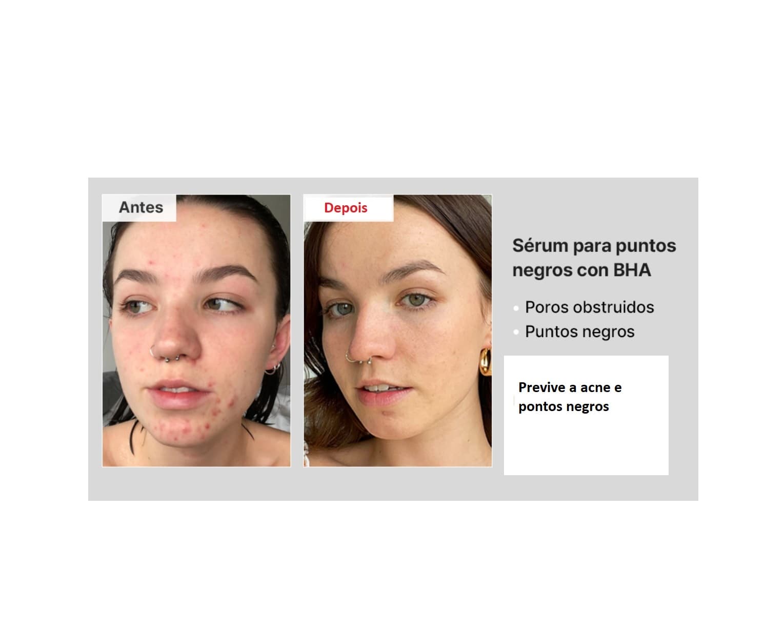 Sérum Éliminateur de Points Noirs BHA 4% - 2