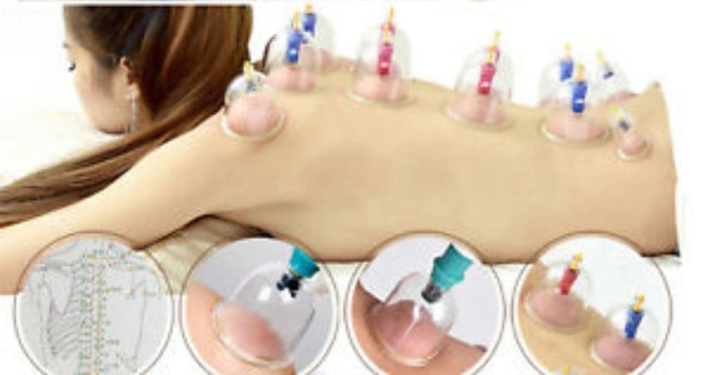 Kit 12 Copas Ventosas + Bomba Masaje Ventosaterapia Vacuoterapia - 2