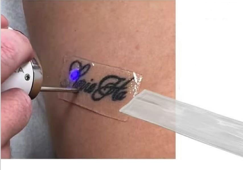 Kit Película de Proteção PFD Silicone para Remoção a Laser - 2