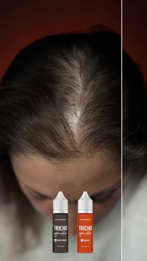 Pigmentos para Tricopigmentação 15ml – AS Company - 7
