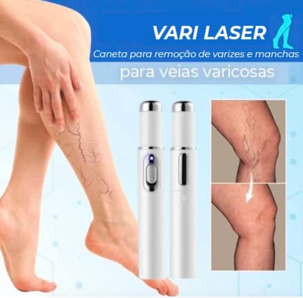 Vari Care - Stift zur Entfernung von Krampfadern, Flecken und Akne - 3