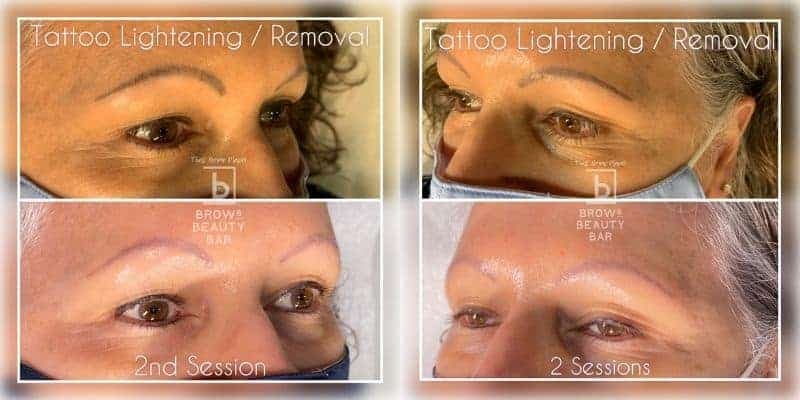 Lift Despigmentante Profesional – 15ml - 3